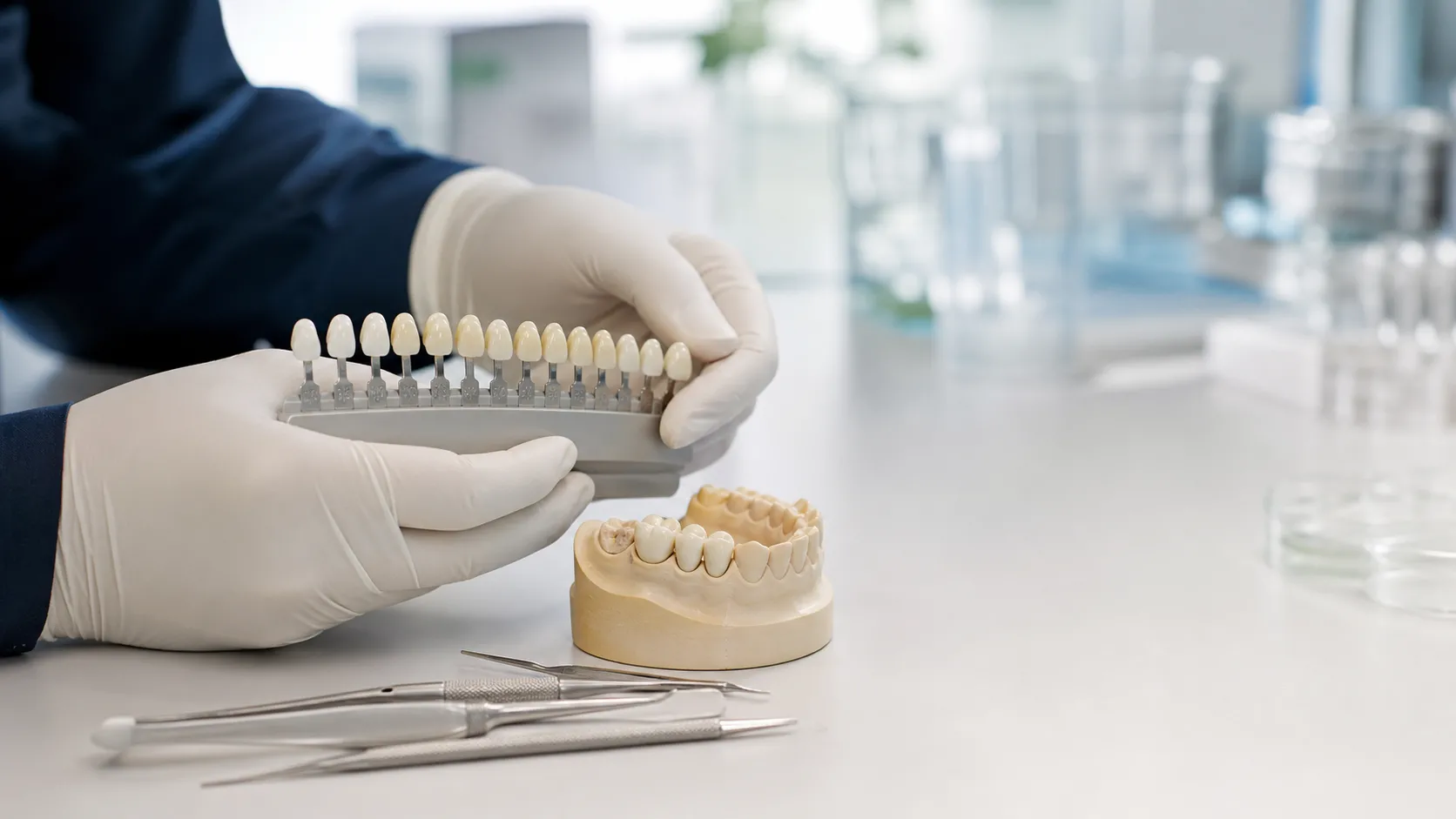 Dental Crowns in Turkey: Materials, Timeline and Questions to Ask